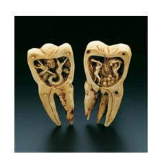 История стоматологии с древнейших времен