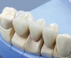 Все, что нужно знать об ортопедии в стоматологии: предназначение, возможности, варианты лечения
