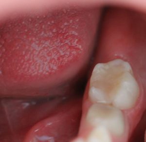 Детская стоматология - примеры работ