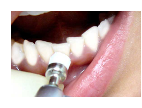 Правильная гигиена полости рта – что это значит?