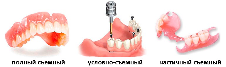 Как привыкать к съемным. Как привыкать к съемным