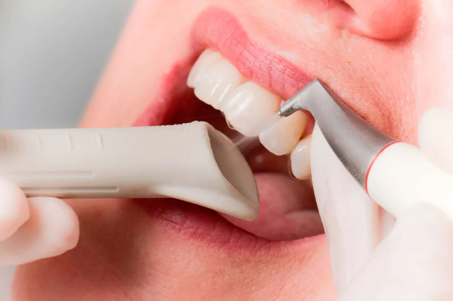 Зубная гигиена перед ФГДС: почему лучше не чистить зубы?
