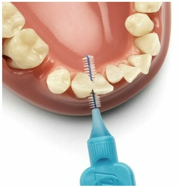 интердентальные ершики для чистки зубов фото 