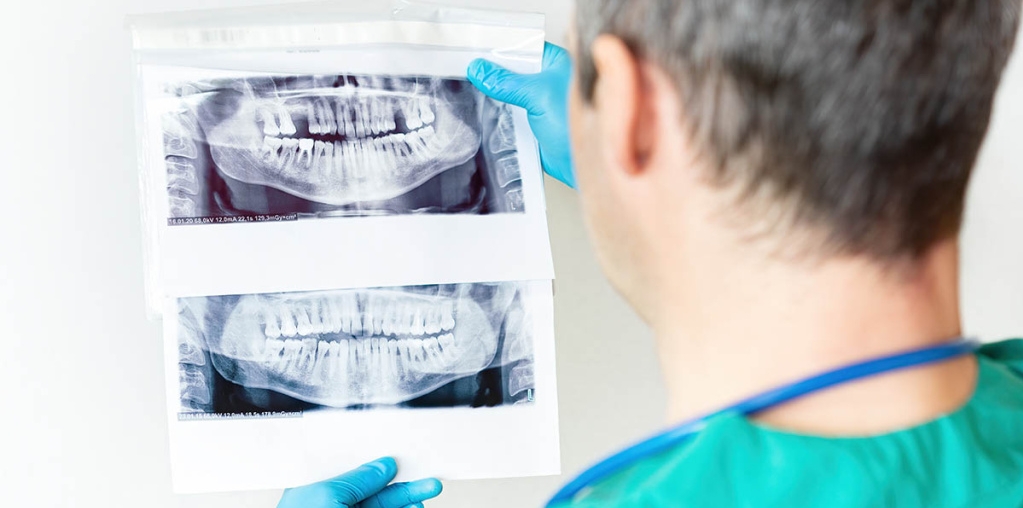анализы перед имплантацией зубов фото