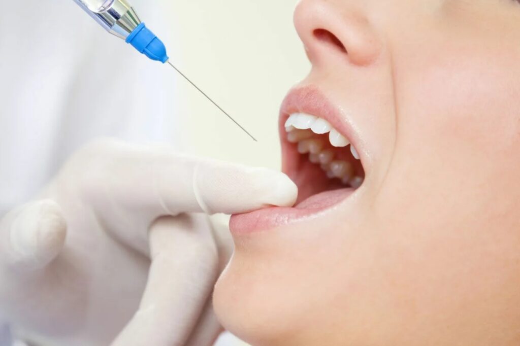 анестезия при имплантации зубов фото
