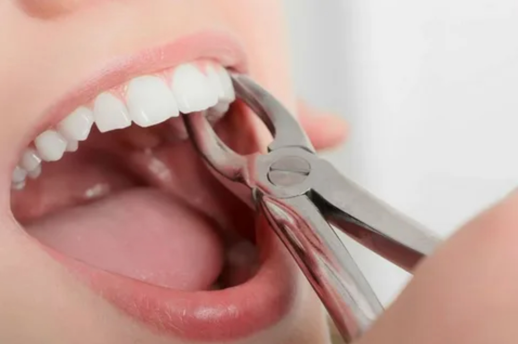 протезирование зуба после удаления фото
